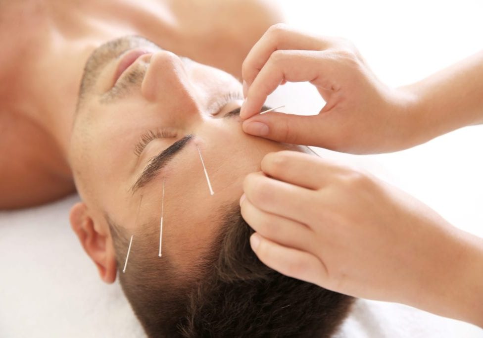 What to expect from an Acupuncture Session What to expect from an Acupuncture Session